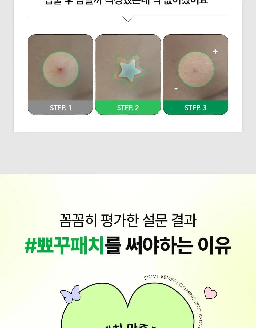 [라이즈 PICK] 유이크 바이옴 레미디 카밍 스팟 패치 2종 택 1 (단품/기획) 상세페이지 11